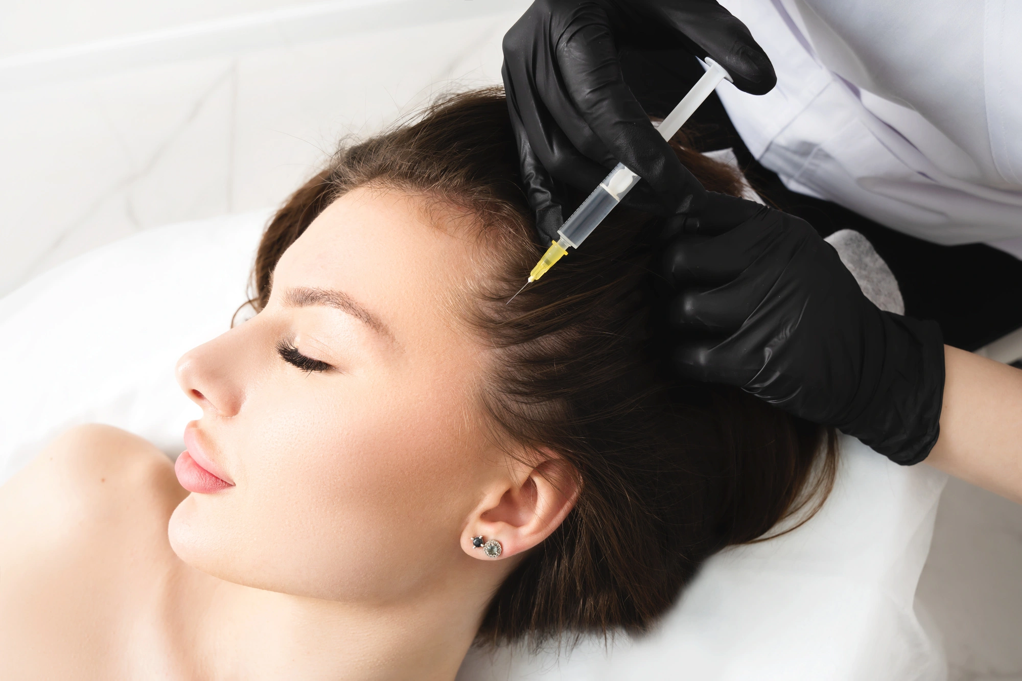 Young Woman Getting Hair Restoration Treatment in Sycamore, IL | Nuvo Aesthetics Clinic