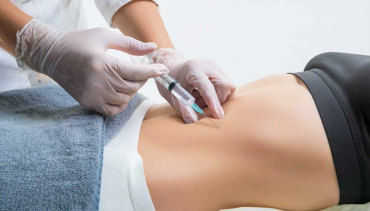 Fat Dissolving Injections by Nuvo Aesthetics Clinic in Sycamore, IL