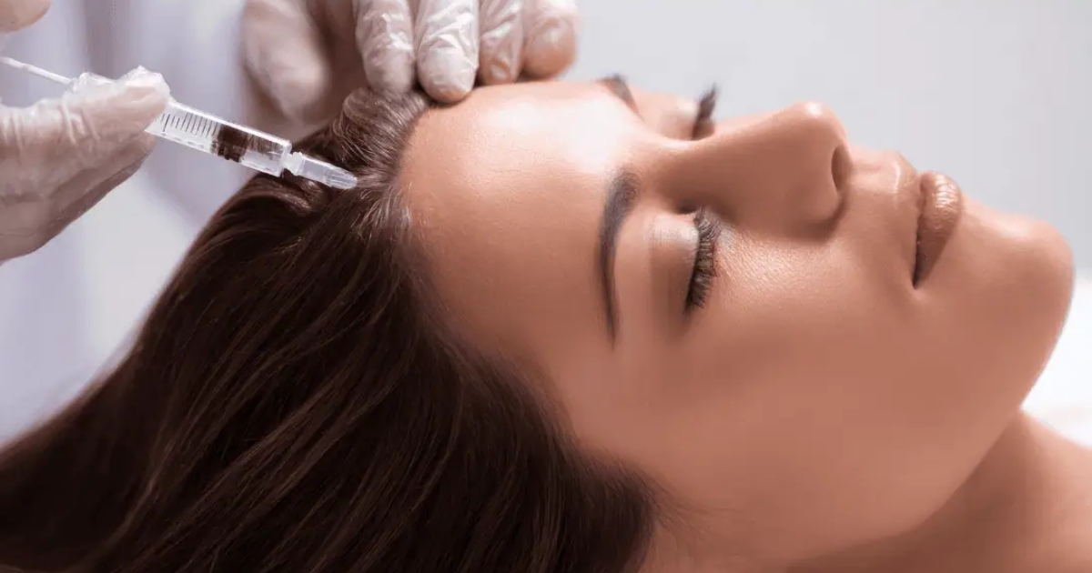 Hair Restoration by Nuvo Aesthetics Clinic in Sycamore, IL